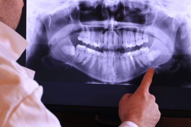Best Emergency TMJ Treatment in Ahtanum, WA